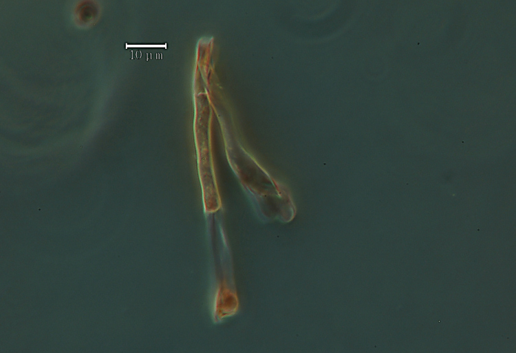 Crosta bianca da determinare - foto6870(Rigidoporus undatus)